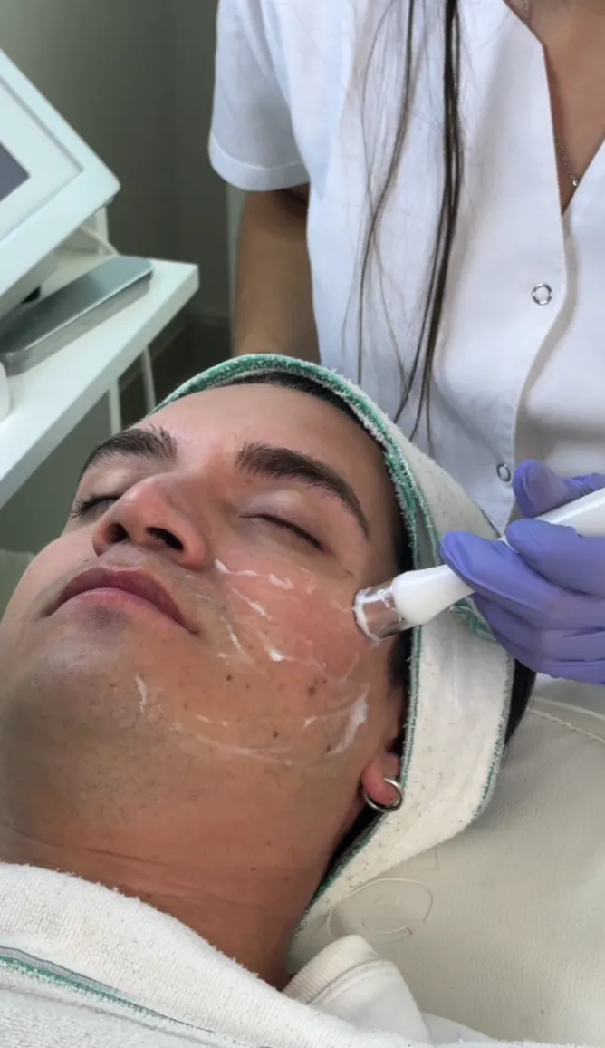 Radiofrecuencia facial aplicada sobre la mejilla con cabezal
